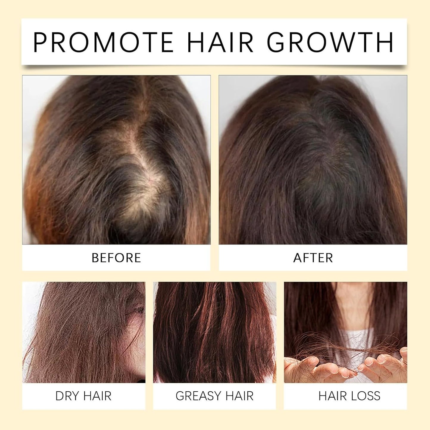 Aceite de batana para el crecimiento del cabello, fórmula líquida 4 en 1, aceite de semillas de romero, ricino y calabaza, fortalece, nutre el cabello dañado, regeneración natural del cabello para adelgazar el cabello